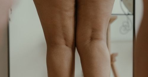 Blog Zéro-Déchet : Anti cellulite naturel